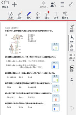 小テスト